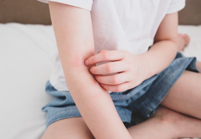 Kind kratzt sich in der Ellenbeuge