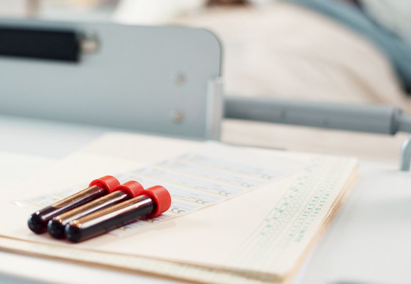 Blutröhrchen bei einem Krankenhausbett