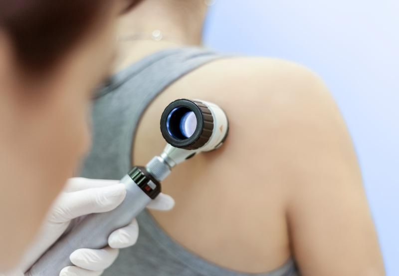 Hautärztin untersucht Rücken einer Patientin