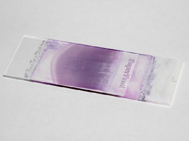 Beim Blutausstrich wird ein Blutstropfen auf einem Glasplättchen (Objektträger) dünn ausgestrichen, gefärbt und mikroskopisch untersucht