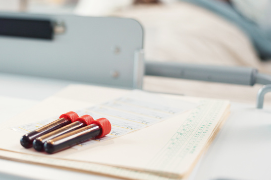 Blutröhrchen und Patientenakte an einem Krankenhausbett