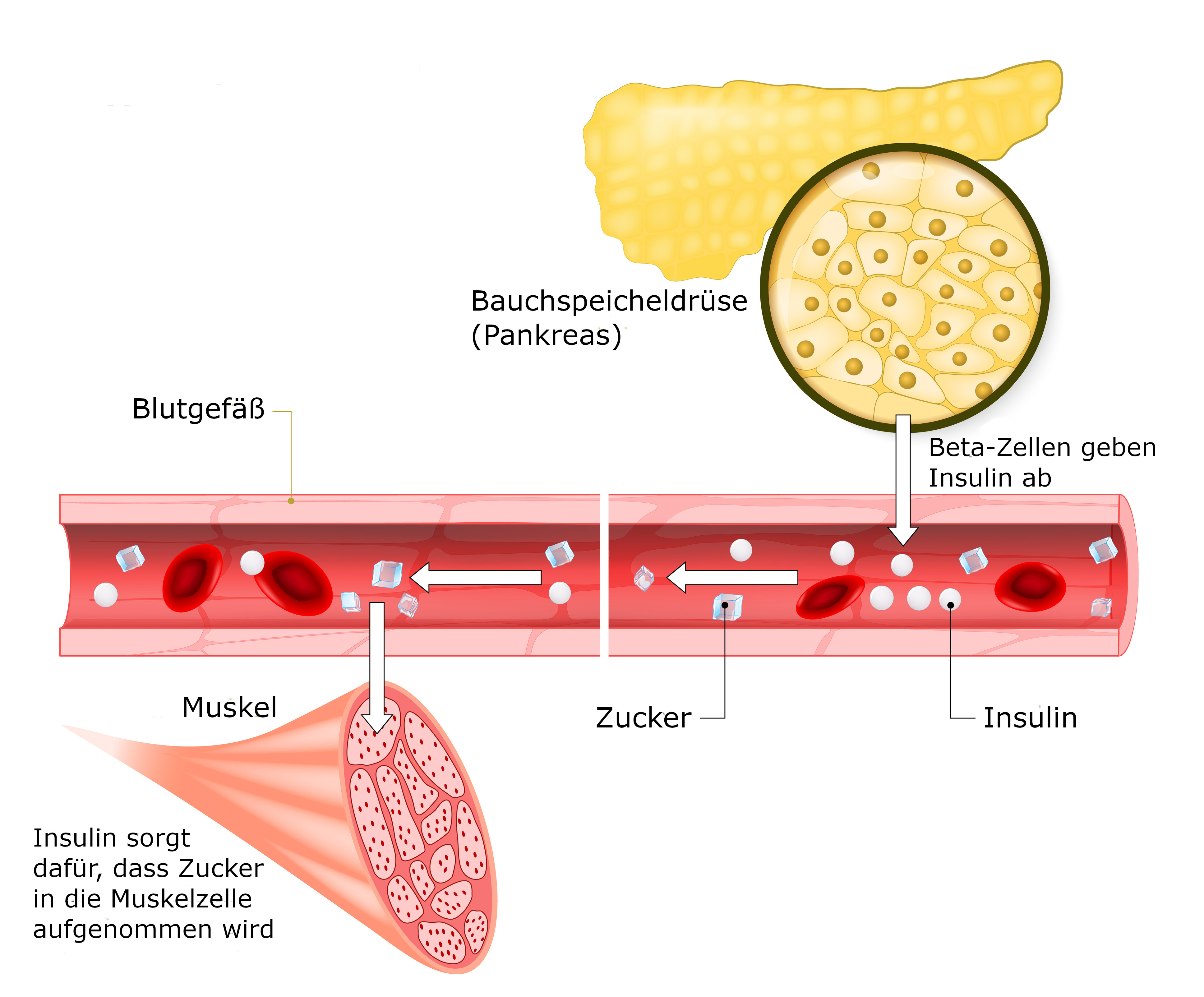 Symbolgrafik Insulin und Glukose