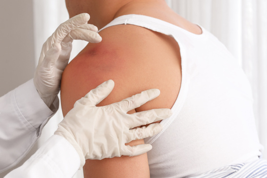 Arzt untersucht Schulterverletzung eines Mannes