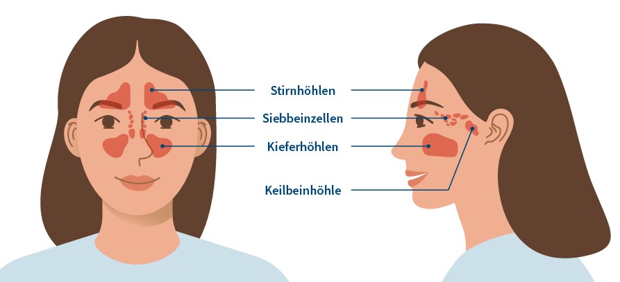 Grafik Nasennebenhöhlen