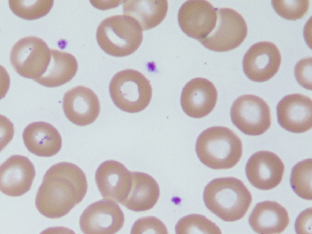 Rote Blutkörperchen im Blutausstrich