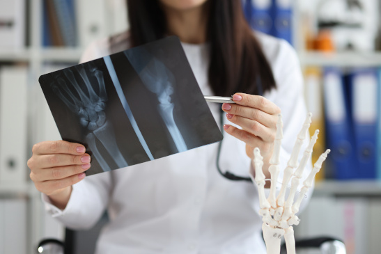 Ärztin betrachtet Röntgenbild einer Hand