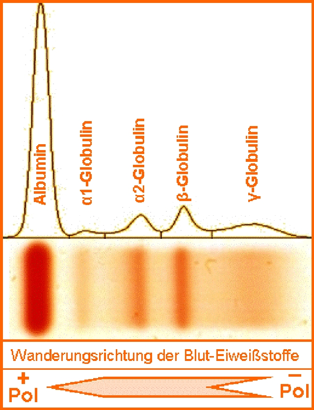 Auftrennung der Serum-Eiweißstoffe im elektrischen Feld