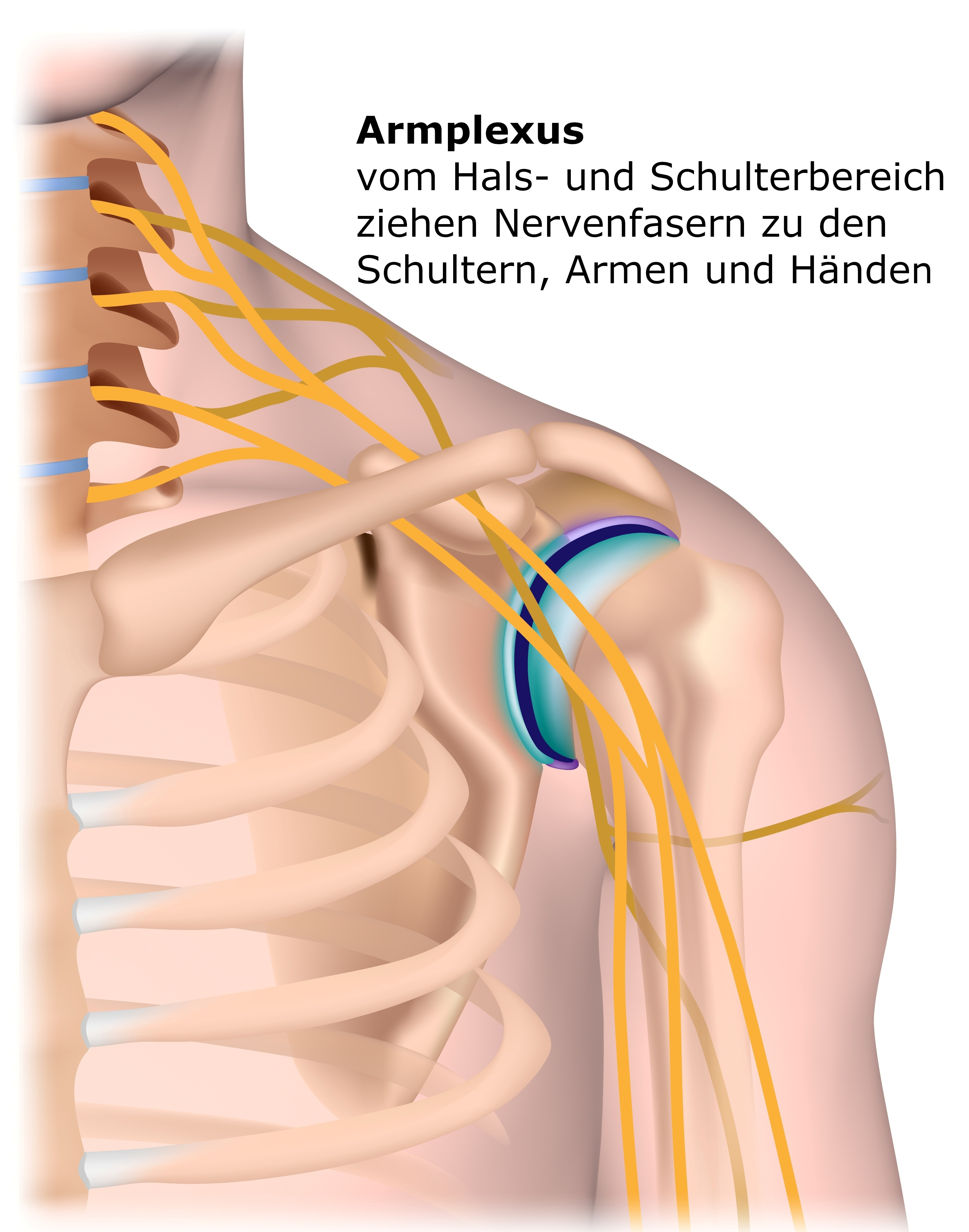 Grafik Armplexus