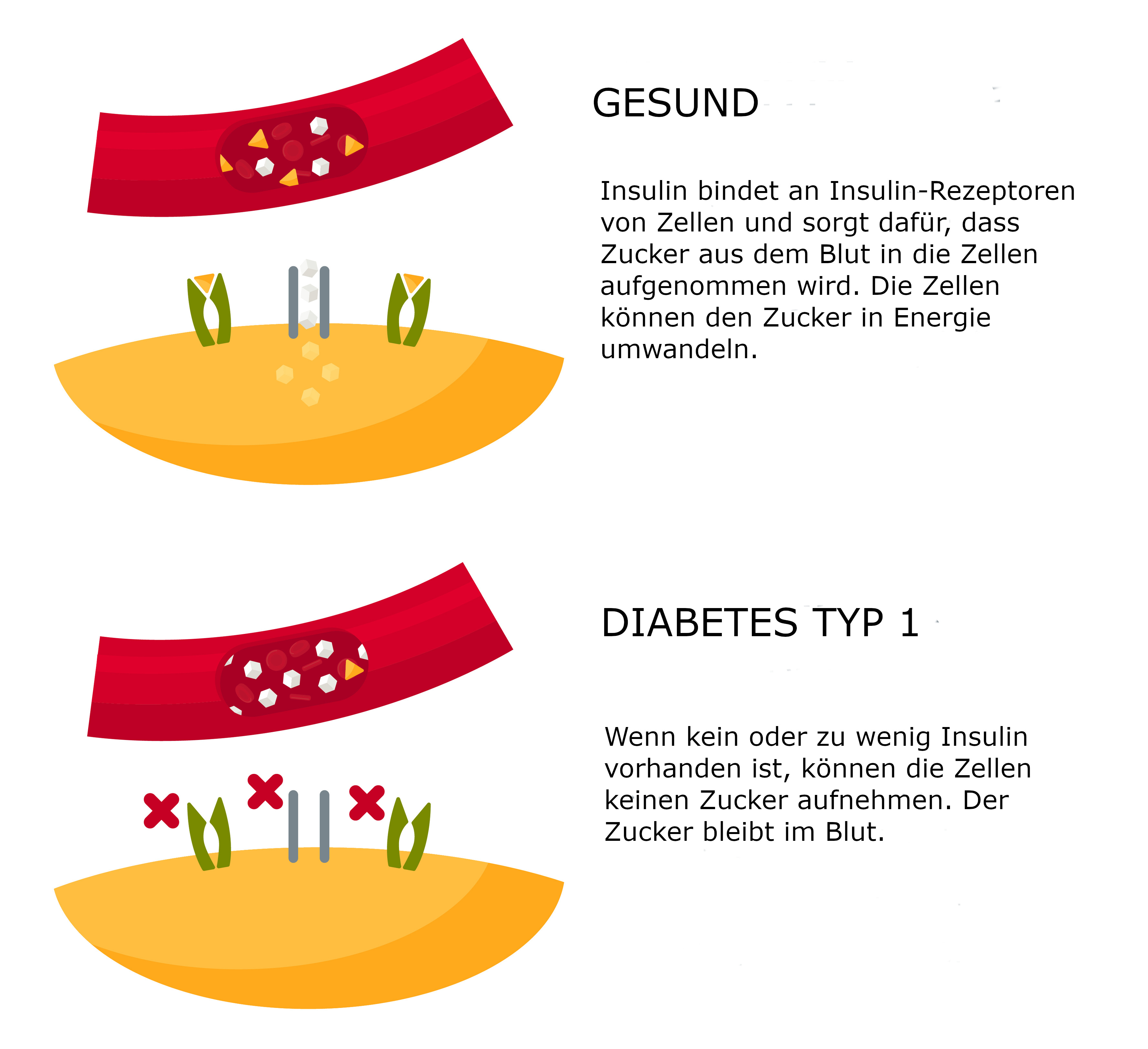 Symbolgrafik Typ-1