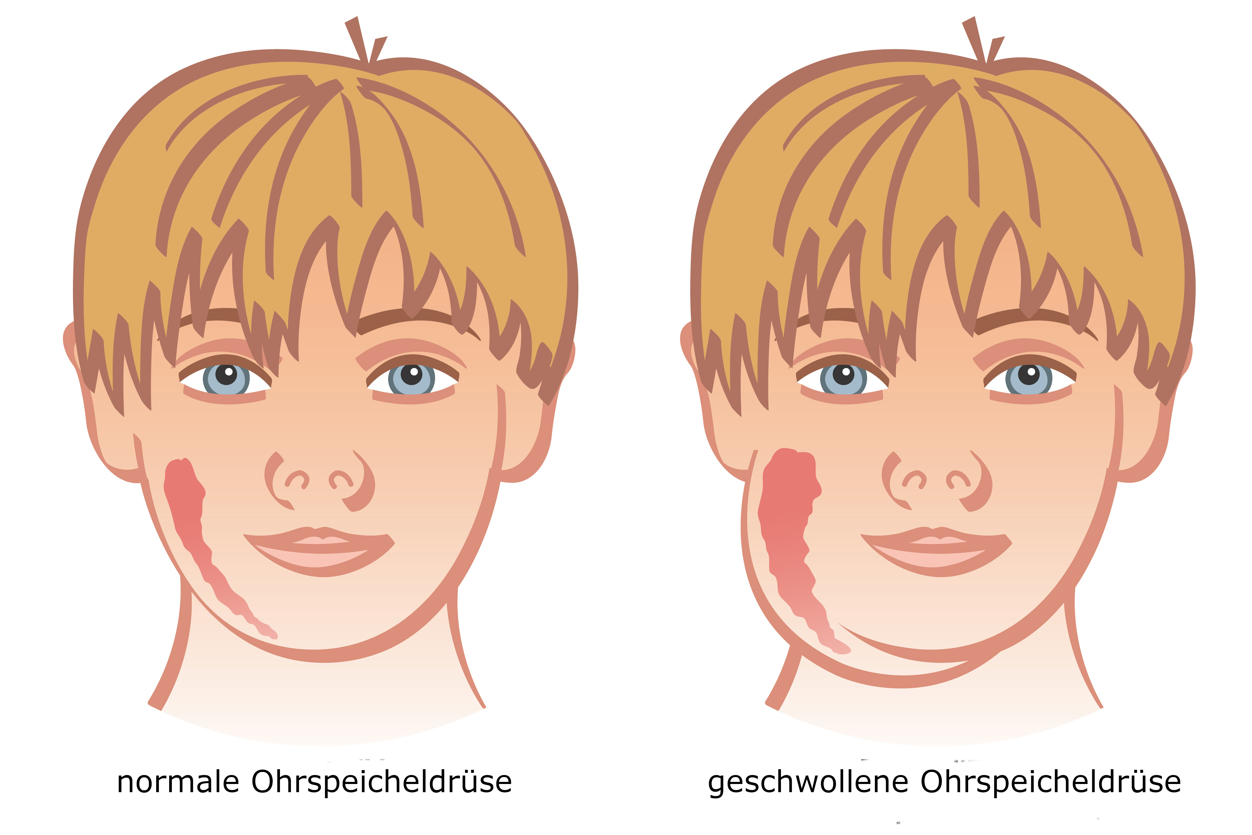 Symbolbild Ohrspeicheldrüse