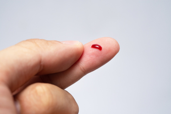 Finger mit Blutstropfen