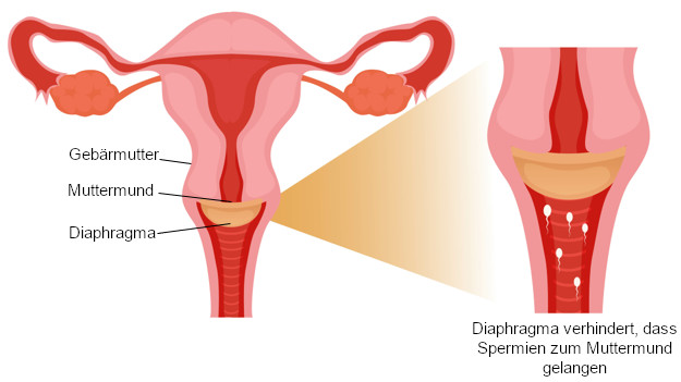 Grafik Diaphragma Wirkweise