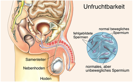 Fruchtbarkeit: Spermienzahl bei Männern seit Siebzigerjahren